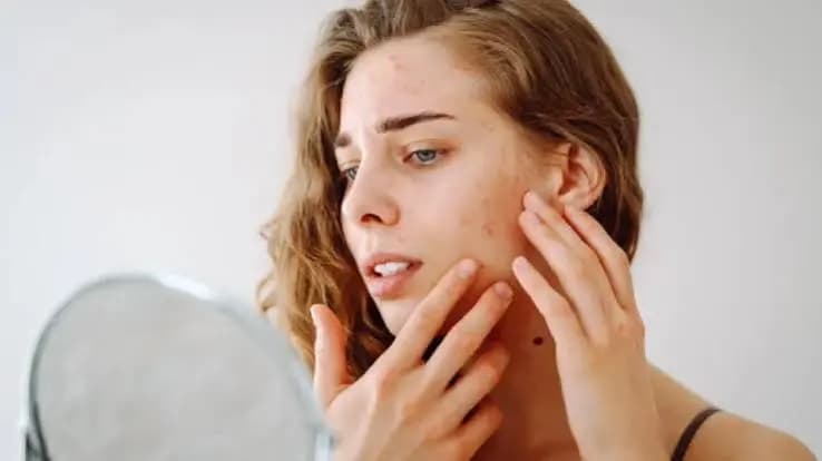 How Delhi's Pollution Season Affects Your Skin (and What Actually Helps)